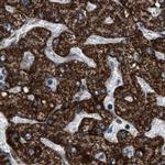 HIBADH Antibody in Immunohistochemistry (IHC)