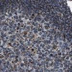 HIBADH Antibody in Immunohistochemistry (IHC)