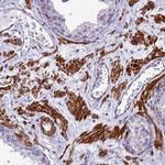 POP7 Antibody in Immunohistochemistry (IHC)