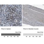 FGL2 Antibody in Immunohistochemistry (IHC)