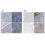 FGL2 Antibody in Immunohistochemistry (IHC)