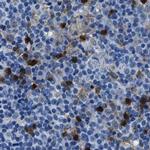 FGL2 Antibody in Immunohistochemistry (IHC)