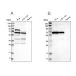 NOP58 Antibody in Western Blot (WB)