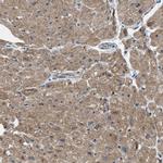 PDP1 Antibody in Immunohistochemistry (IHC)