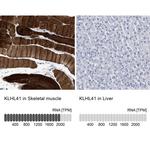 KLHL41 Antibody in Immunohistochemistry (IHC)