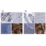 KLHL41 Antibody in Immunohistochemistry (IHC)