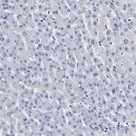 KLHL41 Antibody in Immunohistochemistry (IHC)