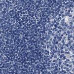 KLHL41 Antibody in Immunohistochemistry (IHC)