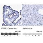 CROCC Antibody in Immunohistochemistry (IHC)