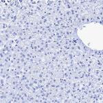 CROCC Antibody in Immunohistochemistry (IHC)