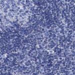 CROCC Antibody in Immunohistochemistry (IHC)