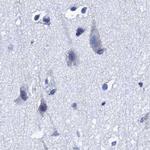 CROCC Antibody in Immunohistochemistry (IHC)