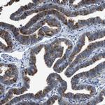 COX19 Antibody in Immunohistochemistry (IHC)