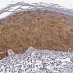 PHGDH Antibody in Immunohistochemistry (IHC)