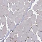 PHGDH Antibody in Immunohistochemistry (IHC)