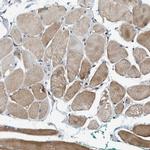 BAIAP2L1 Antibody in Immunohistochemistry (IHC)