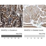 BAIAP2L1 Antibody