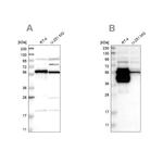 BAIAP2L1 Antibody in Western Blot (WB)