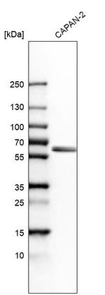 BAIAP2L1 Antibody in Western Blot (WB)