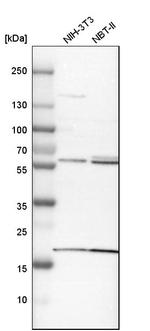 BAIAP2L1 Antibody in Western Blot (WB)