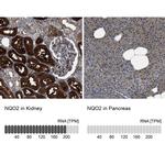 NQO2 Antibody in Immunohistochemistry (IHC)