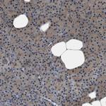 NQO2 Antibody in Immunohistochemistry (IHC)