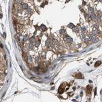 GCC1 Antibody in Immunohistochemistry (IHC)