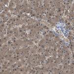 NQO2 Antibody in Immunohistochemistry (IHC)