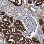 NQO2 Antibody in Immunohistochemistry (IHC)