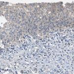 NQO2 Antibody in Immunohistochemistry (IHC)