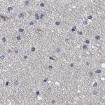 MKS1 Antibody in Immunohistochemistry (IHC)