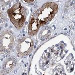 MKS1 Antibody in Immunohistochemistry (IHC)