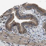 SLC38A10 Antibody in Immunohistochemistry (IHC)