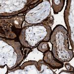 SLC16A3 Antibody in Immunohistochemistry (IHC)