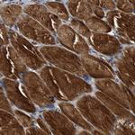 SLC16A3 Antibody in Immunohistochemistry (IHC)