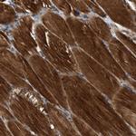 SLC16A3 Antibody in Immunohistochemistry (IHC)