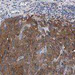 GMPR Antibody in Immunohistochemistry (IHC)