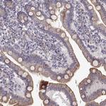 ENTPD8 Antibody in Immunohistochemistry (IHC)