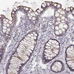 ENTPD8 Antibody in Immunohistochemistry (IHC)