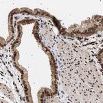 ING2 Antibody in Immunohistochemistry (IHC)