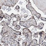 ZNF750 Antibody in Immunohistochemistry (IHC)