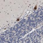 ZNF750 Antibody in Immunohistochemistry (IHC)