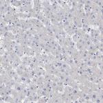 ZNF750 Antibody in Immunohistochemistry (IHC)