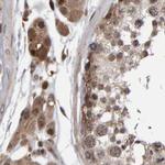 PECR Antibody in Immunohistochemistry (IHC)