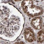 PECR Antibody in Immunohistochemistry (IHC)