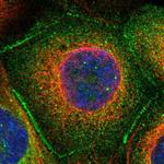 53BP2 Antibody in Immunocytochemistry (ICC/IF)