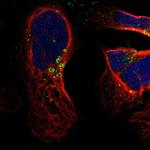 HSD17B11 Antibody in Immunocytochemistry (ICC/IF)