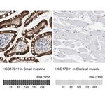 HSD17B11 Antibody in Immunohistochemistry (IHC)