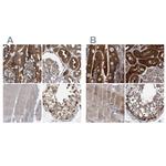 C17orf25 Antibody in Immunohistochemistry (IHC)