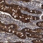 C17orf25 Antibody in Immunohistochemistry (IHC)